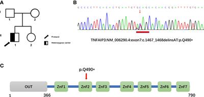 Case Report: A novel mutation in TNFAIP3 in a patient with type 1 diabetes mellitus and haploinsufficiency of A20